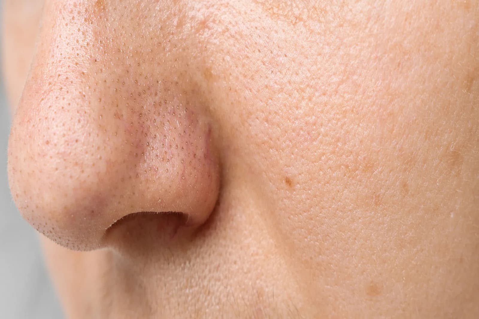 6 Tips For Minimizing Your Pores